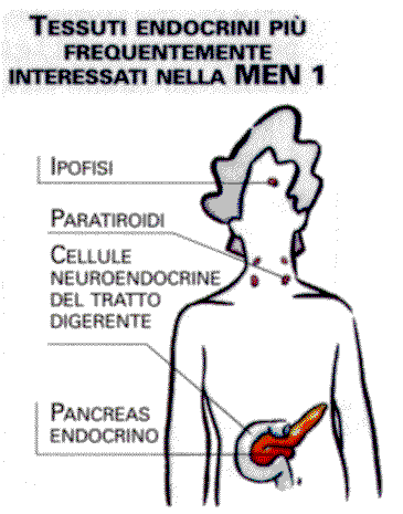 Tessuti endocrini piu' frequentemente interessati nella MEN I