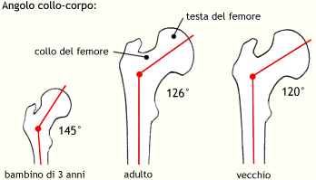 Angolo collo-corpo del femore